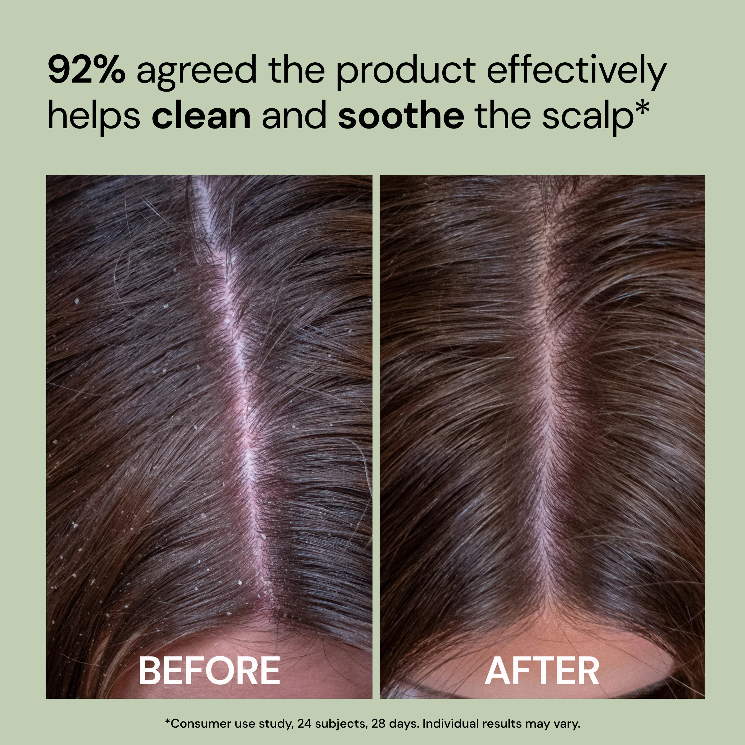 Happy Roots Post-Cleanse Soothing Reset - Image 3