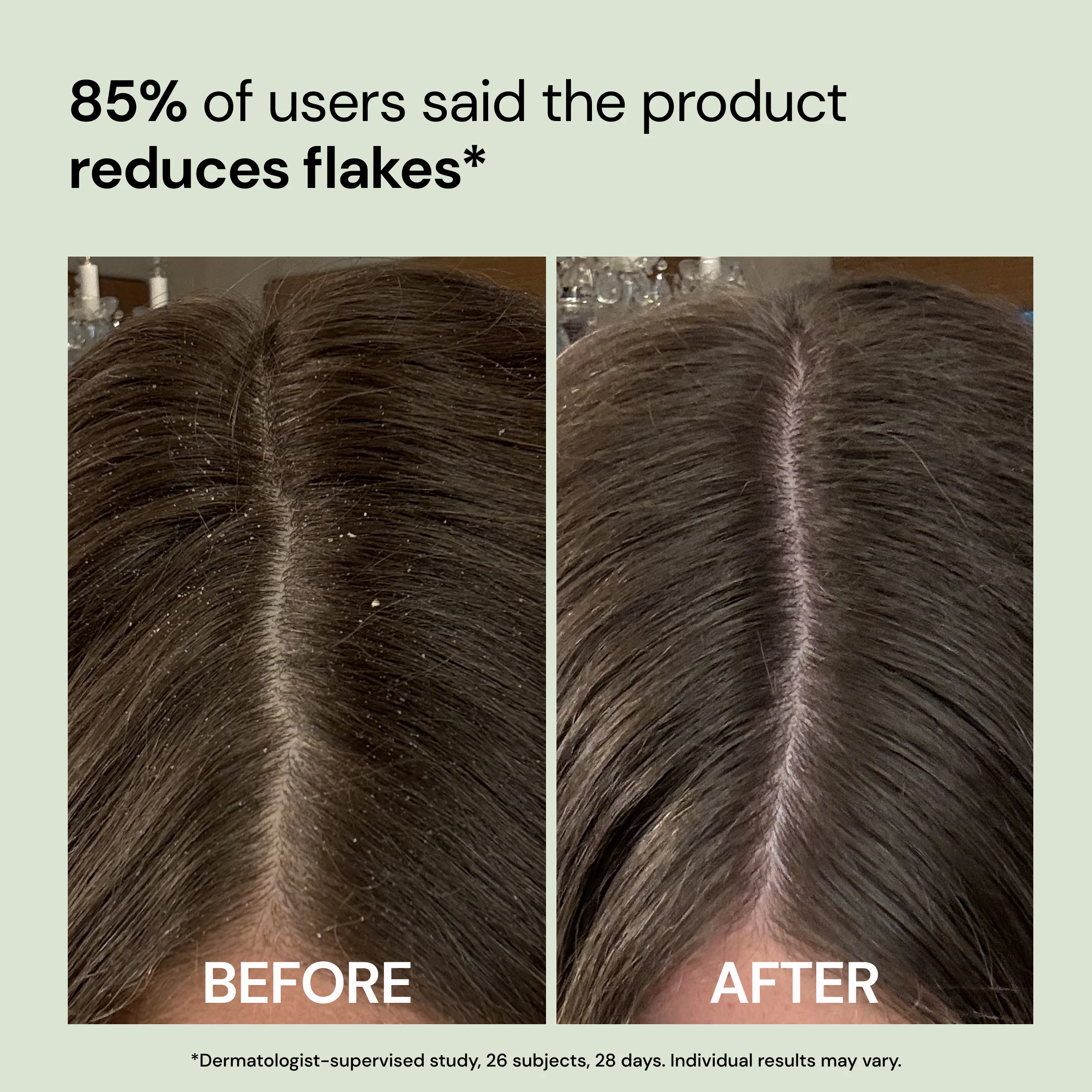 Happy Roots Scalp Calm Serum - Image 5